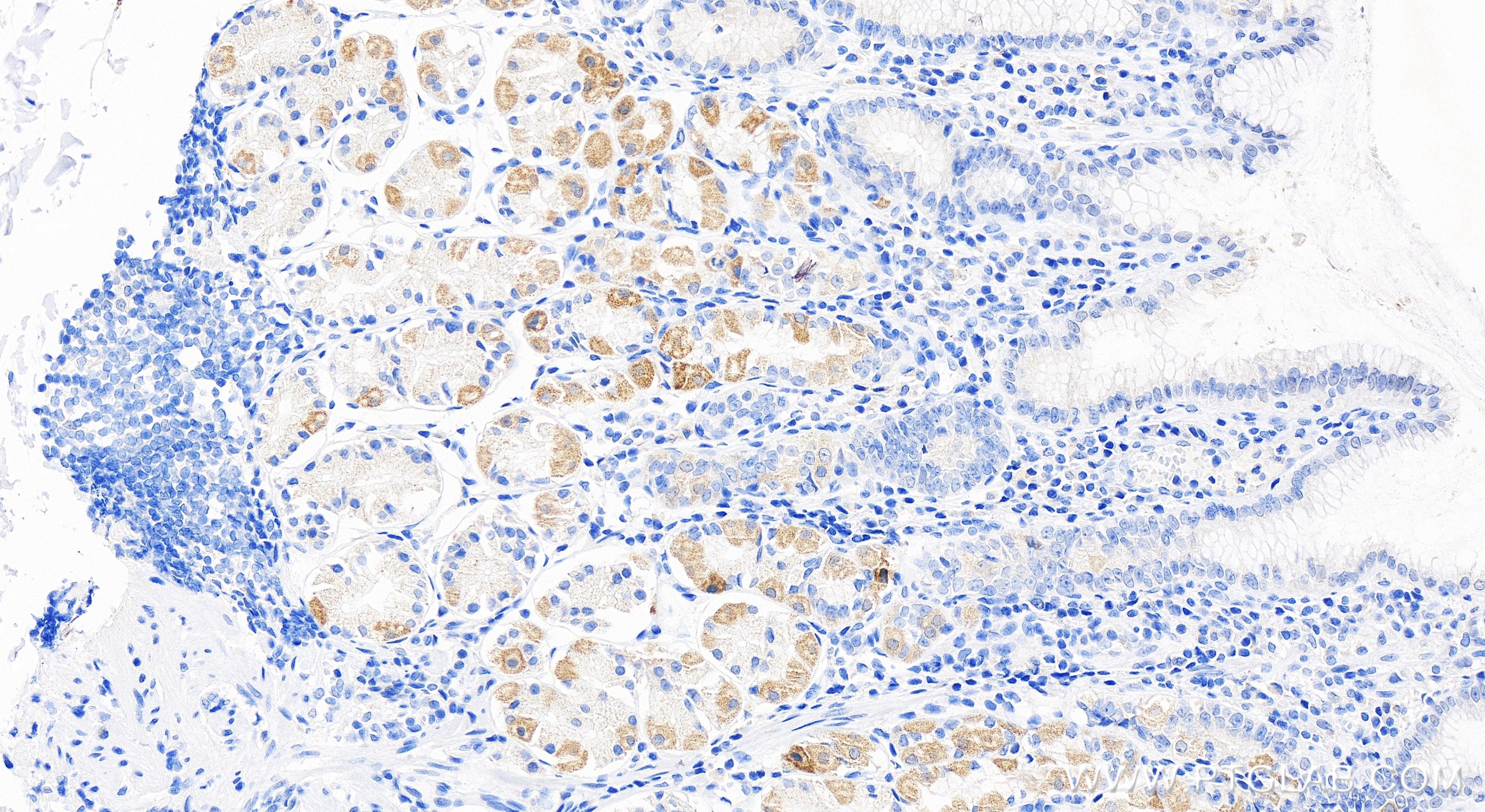 IHC staining of human stomach using 83897-4-RR (same clone as 83897-4-PBS)