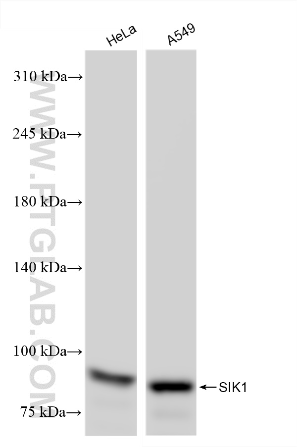 WB analysis using 83897-4-RR (same clone as 83897-4-PBS)