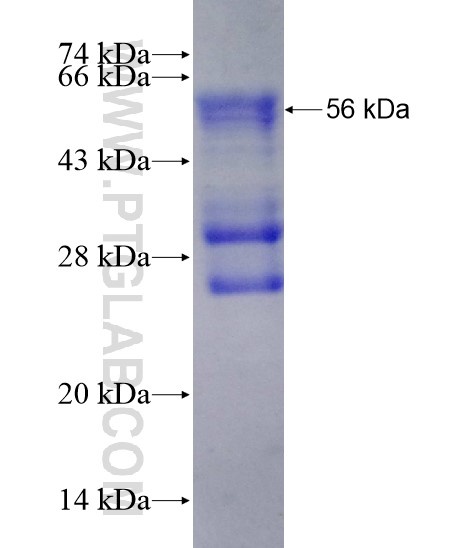 SIK1 fusion protein Ag28481 SDS-PAGE