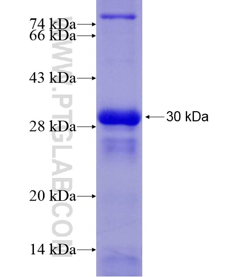 SIK1 fusion protein Ag28491 SDS-PAGE