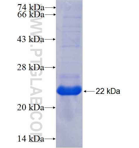 SILV fusion protein Ag25802 SDS-PAGE