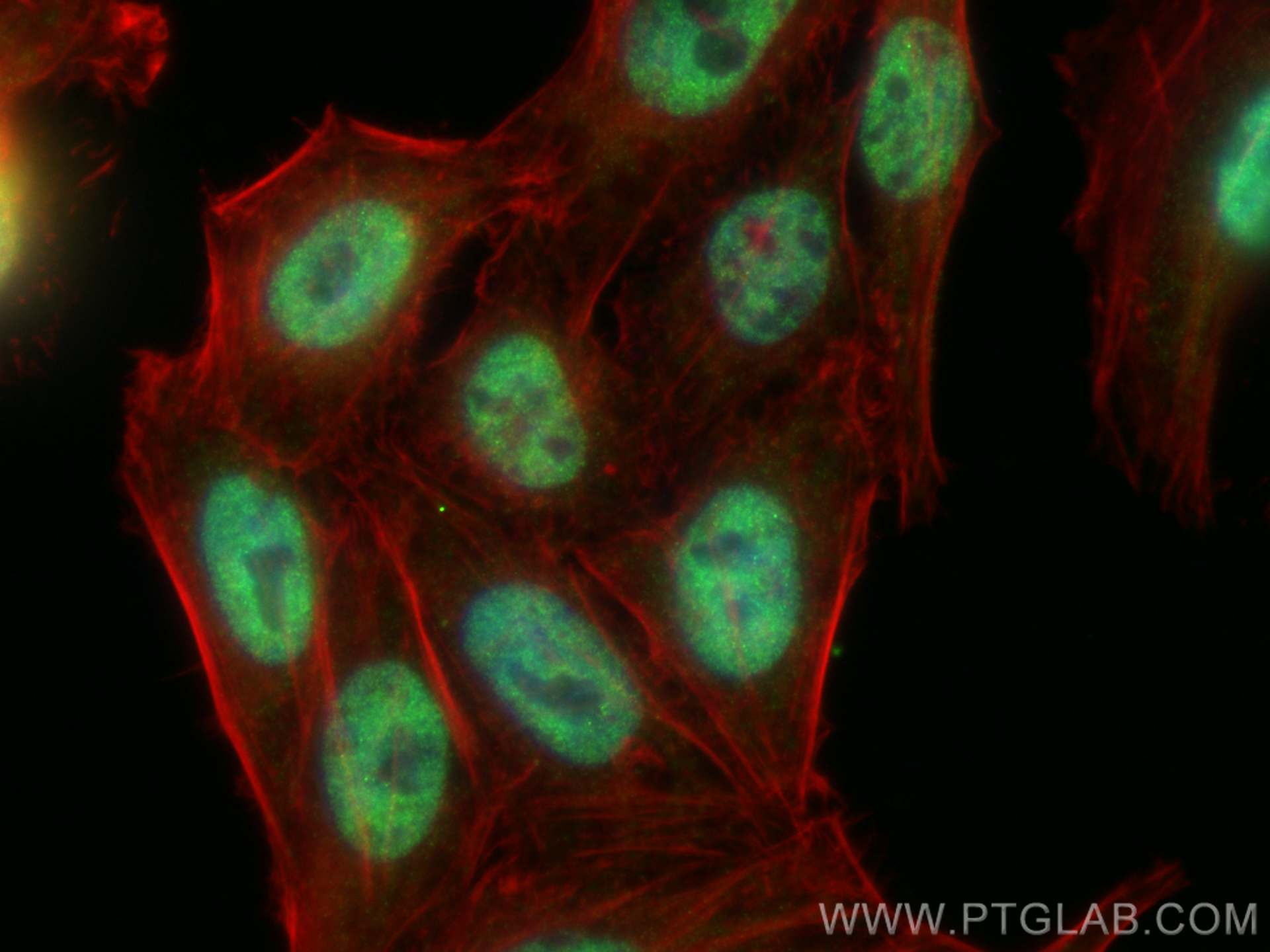 IF Staining of HepG2 using 14638-1-AP