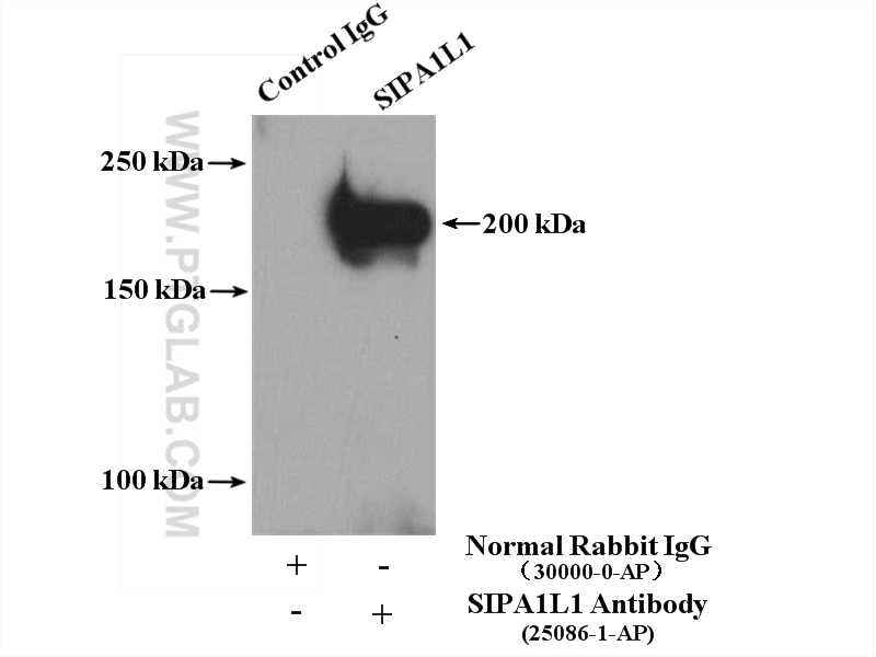 SIPA1L1