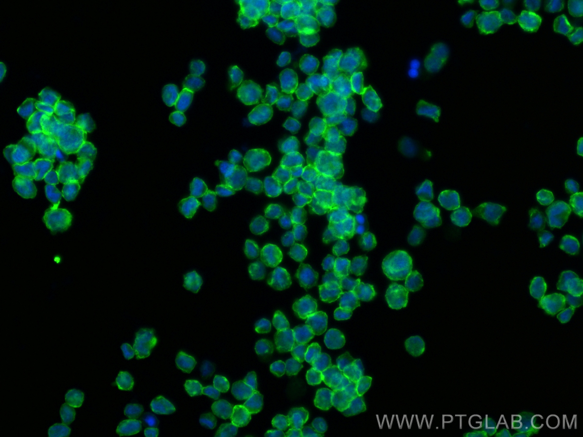 IF Staining of THP-1 using 31485-1-AP