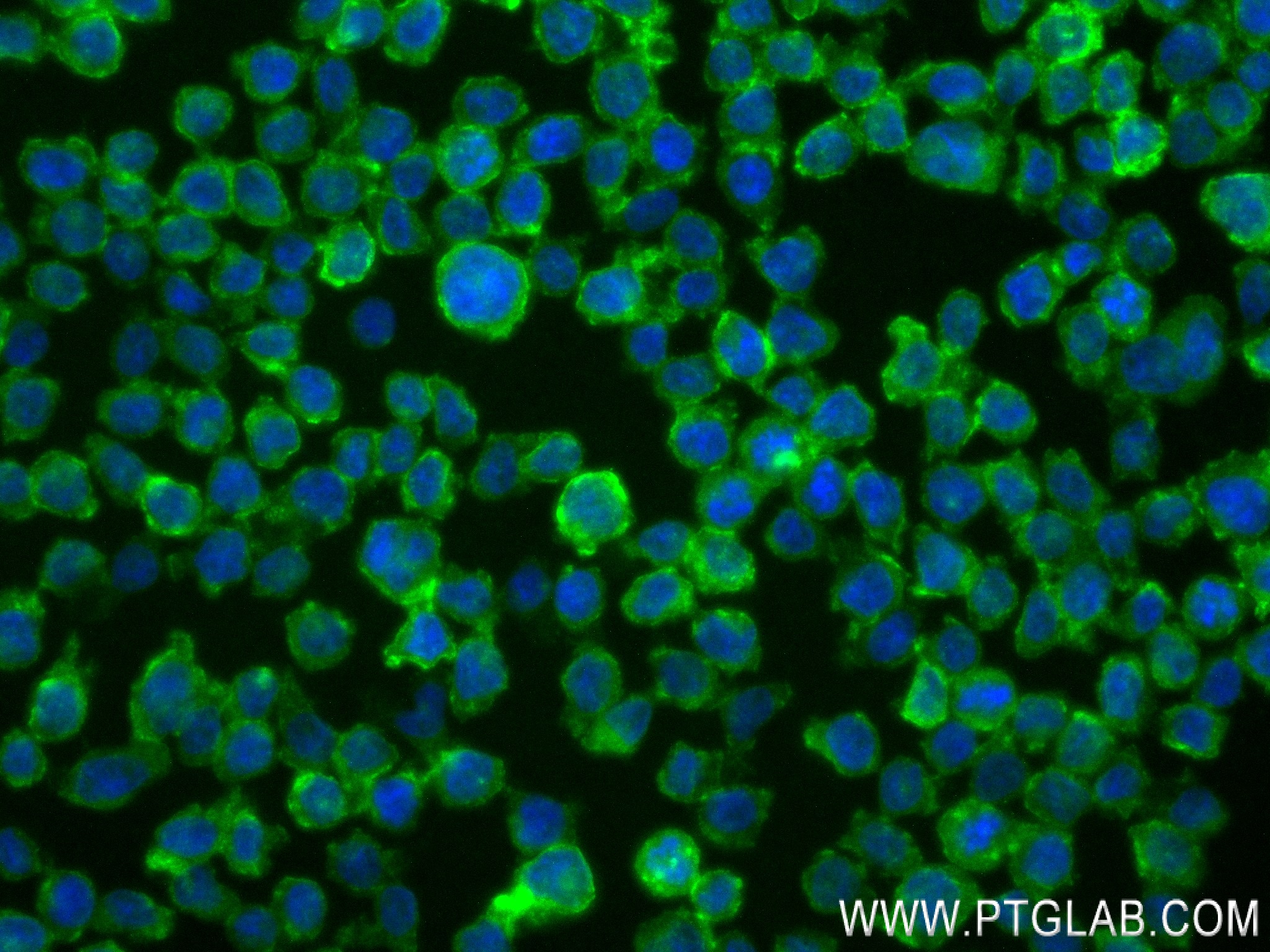 IF Staining of THP-1 using 83729-5-RR (same clone as 83729-5-PBS)