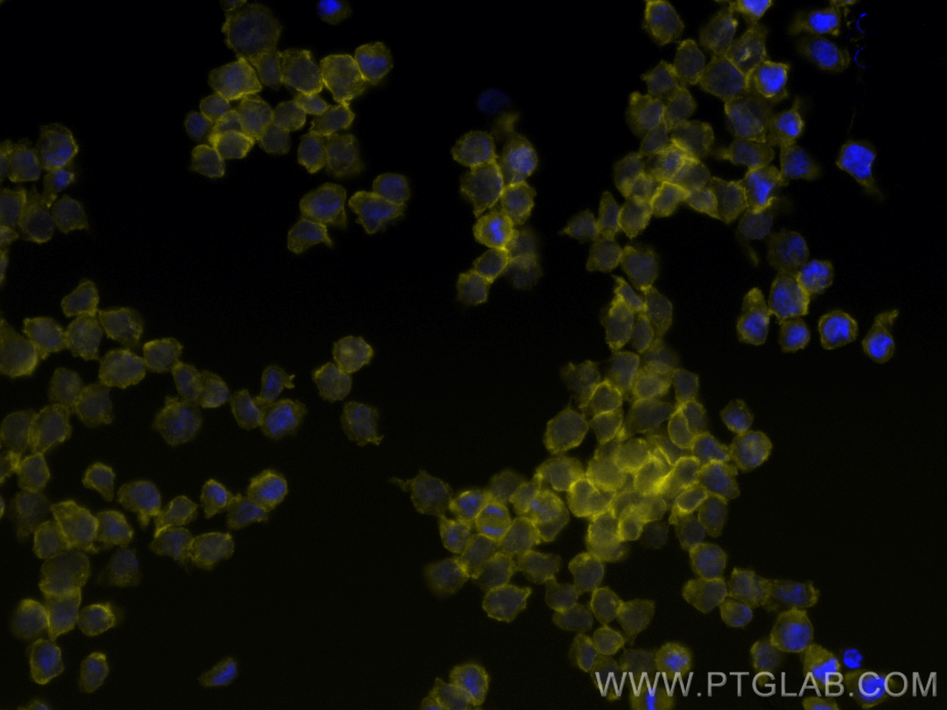 IF Staining of THP-1 using CL532-83729-3