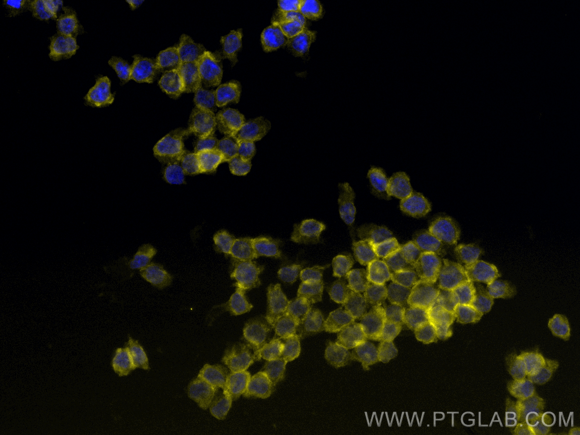 IF Staining of THP-1 using CL532-83729-5