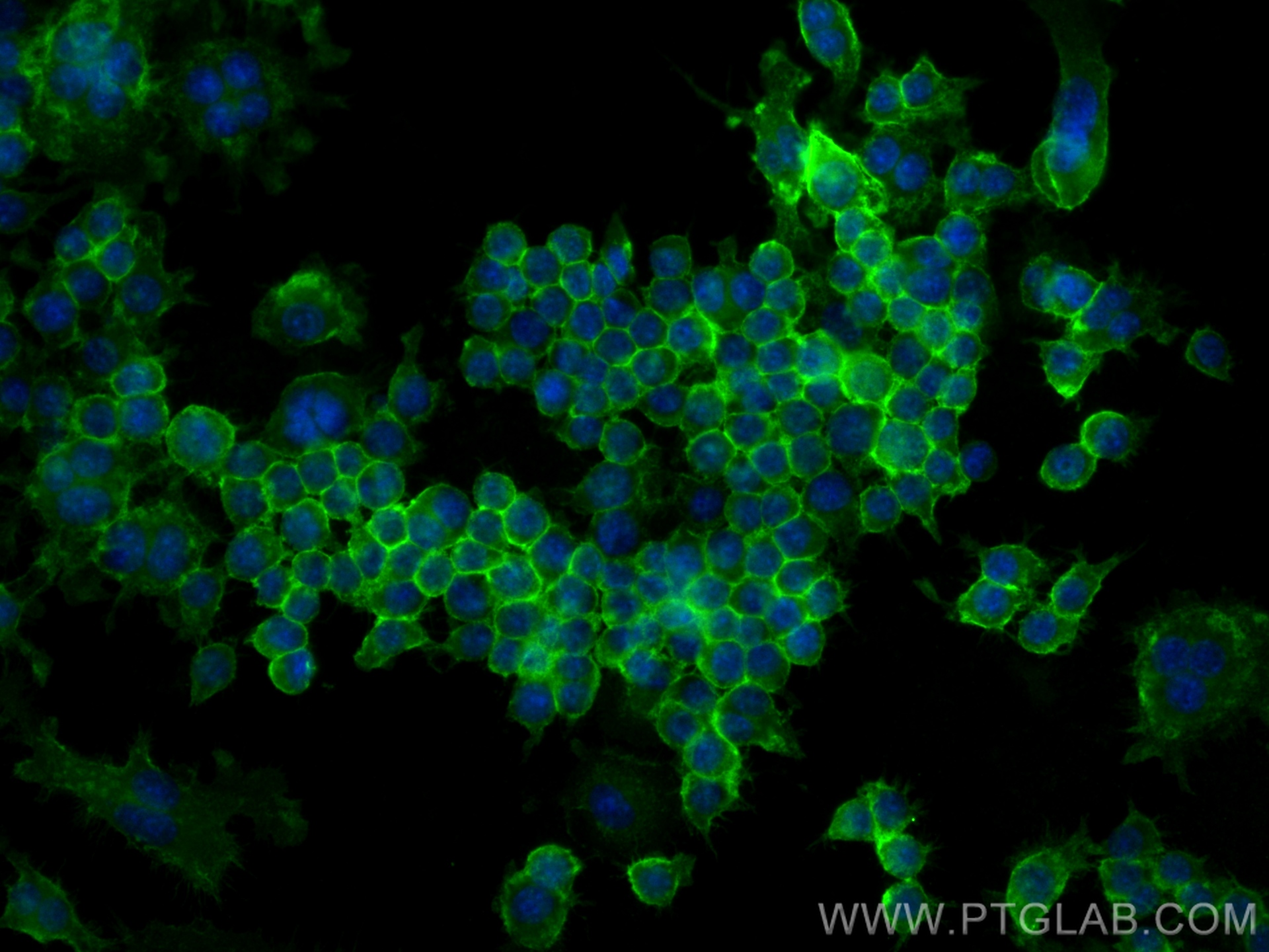 IF Staining of RAW 264.7 using 31952-1-AP