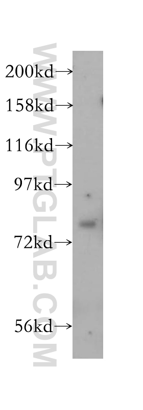 SIRP Alpha/CD172a