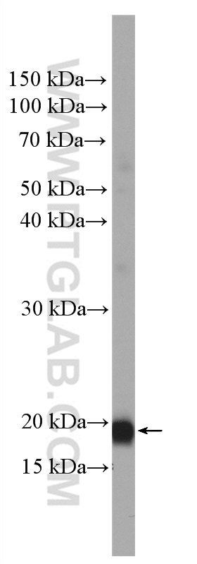 WB analysis of fetal human brain using 26594-1-AP