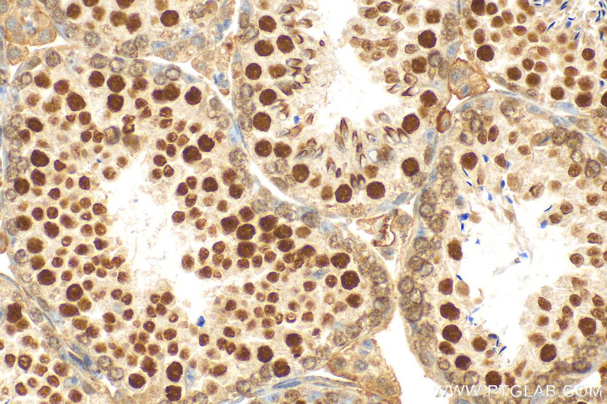 IHC staining of mouse testis using 13161-1-AP