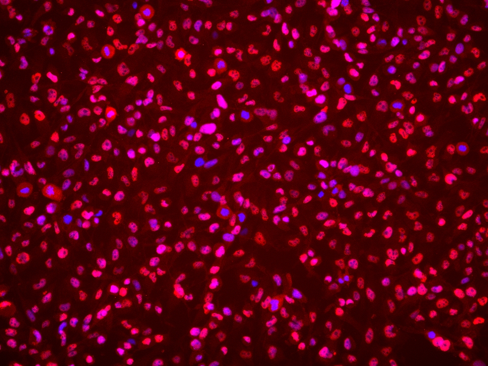 IF Staining of BT-549 using 60303-1-Ig (same clone as 60303-1-PBS)