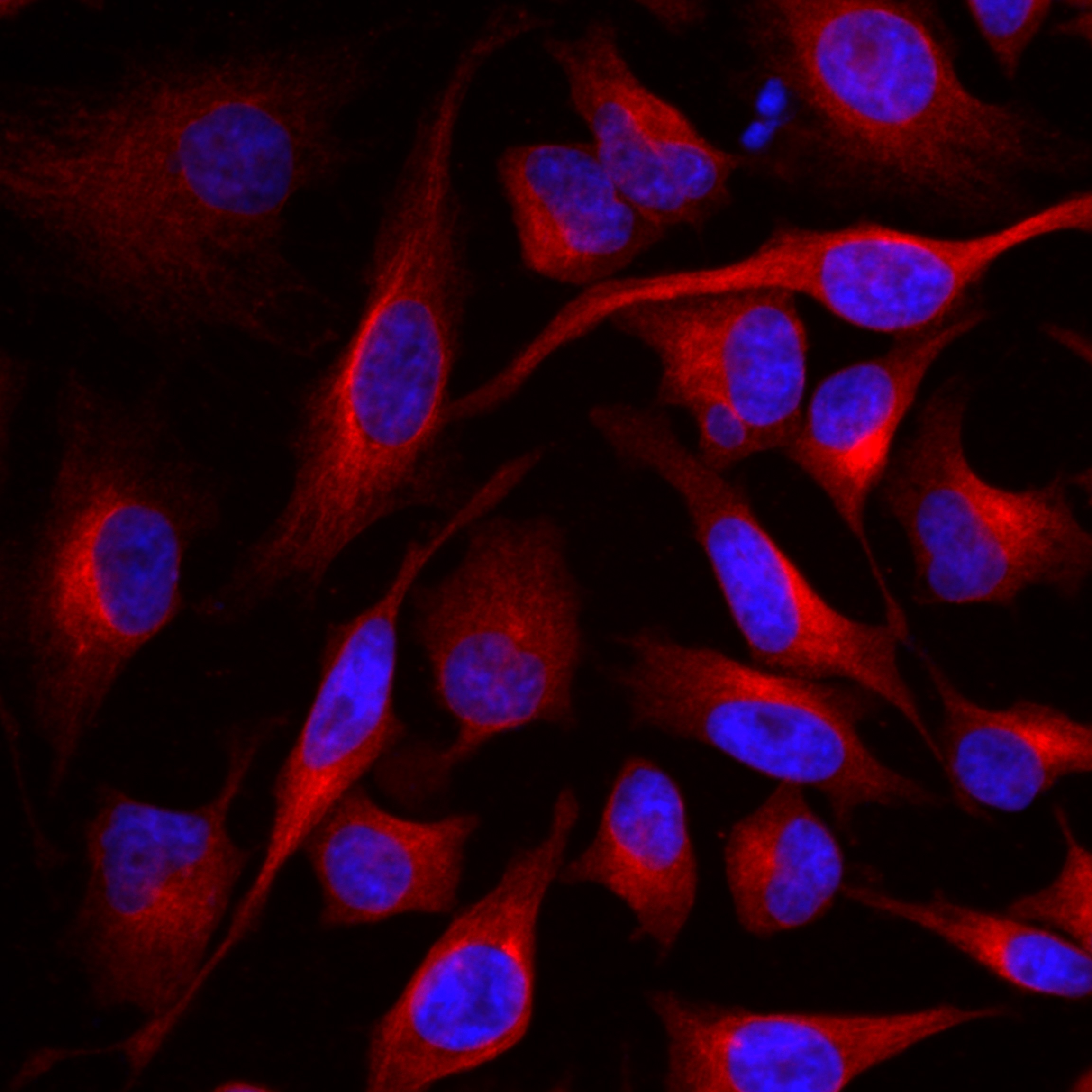 IF Staining of HeLa using 82246-1-RR (same clone as 82246-1-PBS)