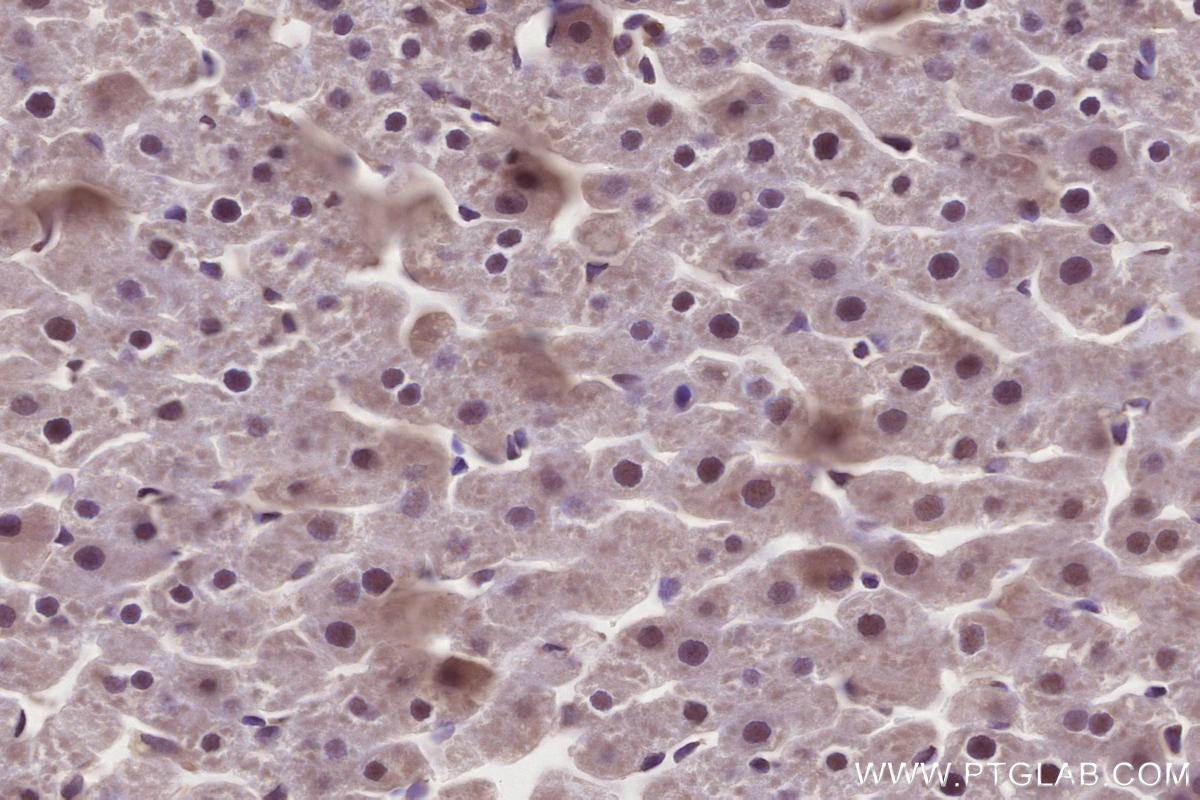 IHC staining of rat liver using 28677-1-AP