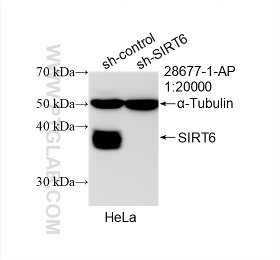 WB analysis of HeLa using 28677-1-AP