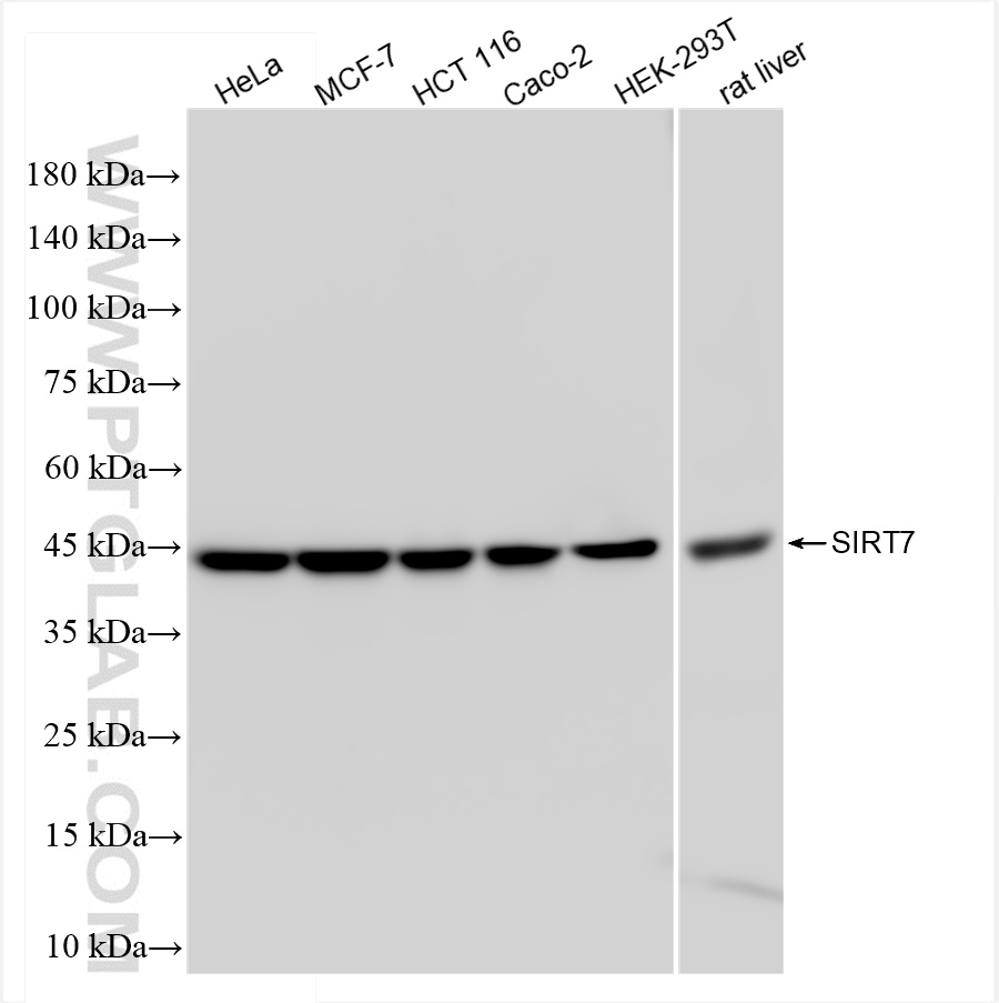 WB analysis using 84805-4-RR