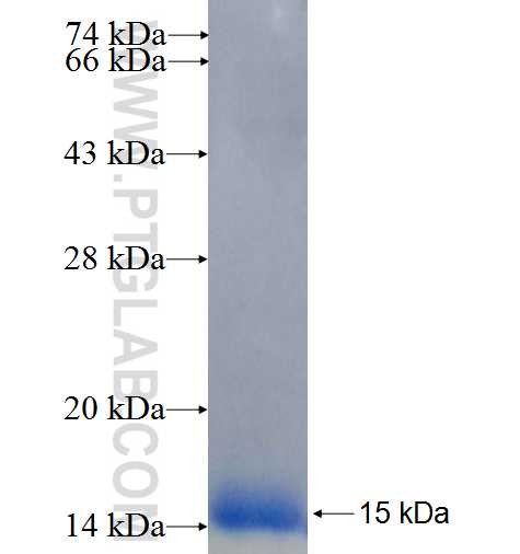 SIVA1 fusion protein Ag25753 SDS-PAGE