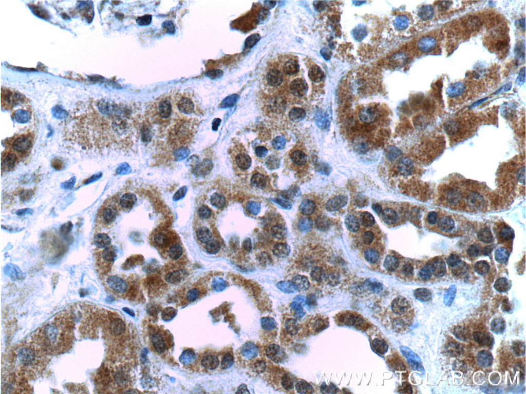 IHC staining of human kidney using 22938-1-AP