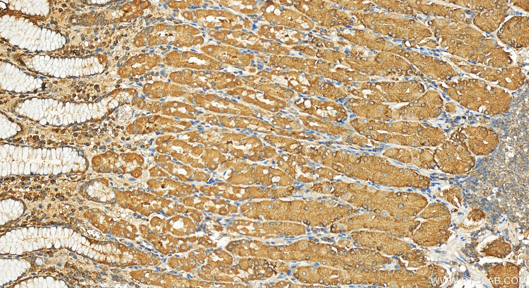 IHC staining of human stomach using 11462-1-AP