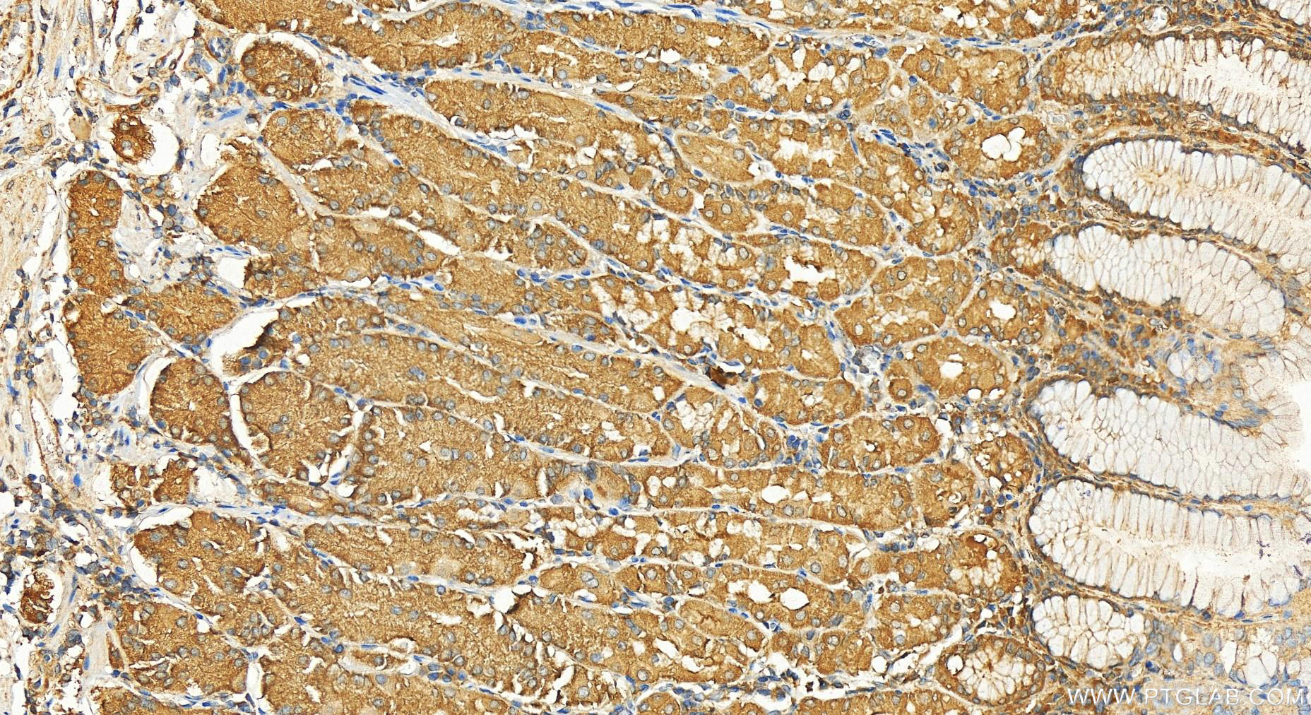 IHC staining of human stomach using 11462-1-AP