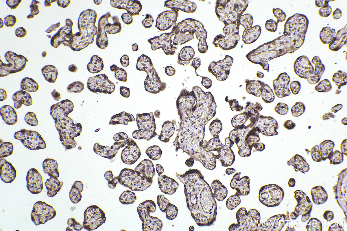 IHC staining of human placenta using 68547-1-Ig