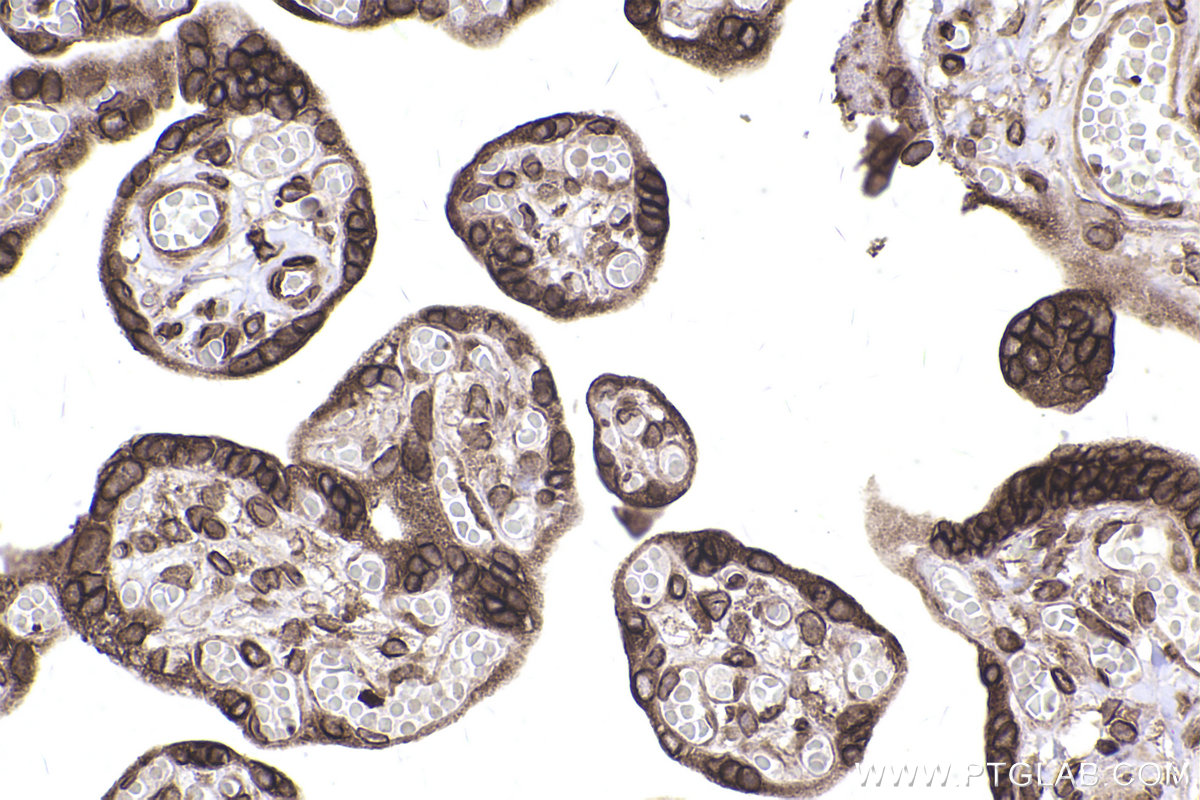 IHC staining of human placenta using 68547-1-Ig