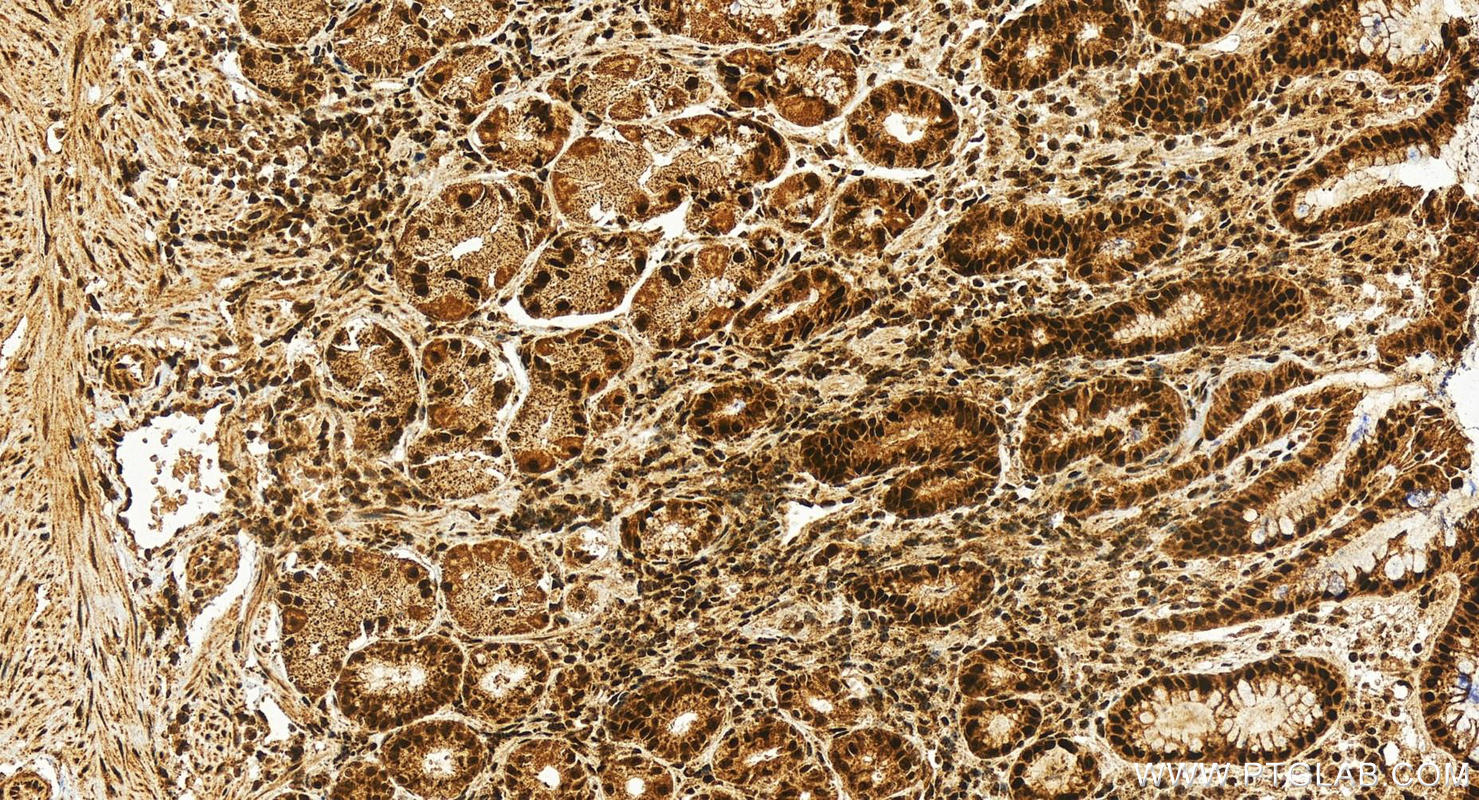 IHC staining of human stomach using 12719-2-AP