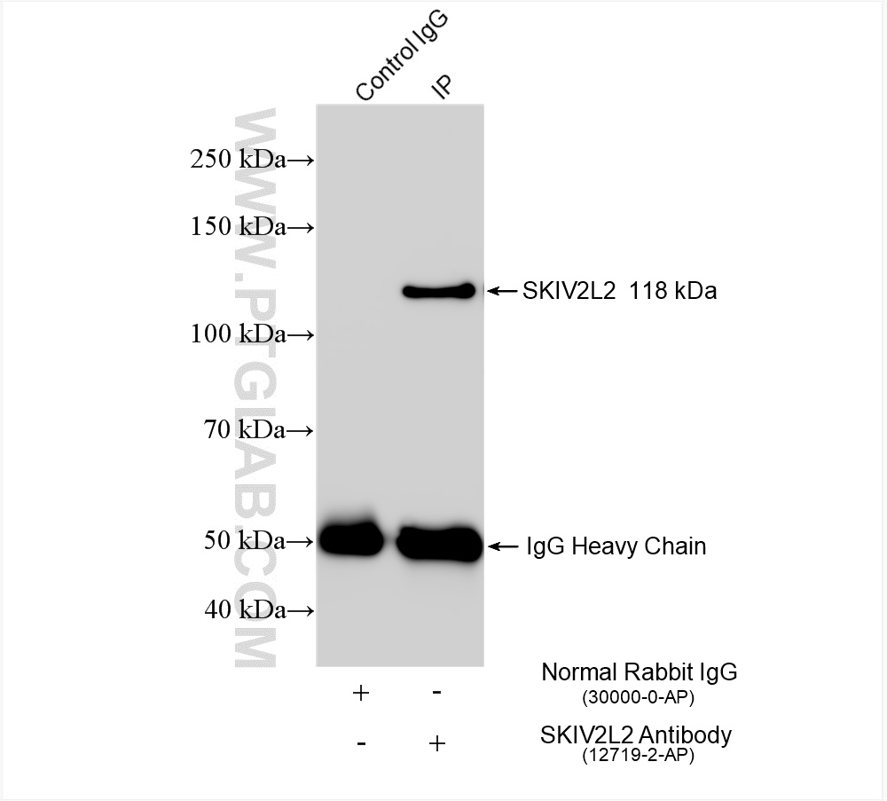 IP experiment of HepG2 using 12719-2-AP