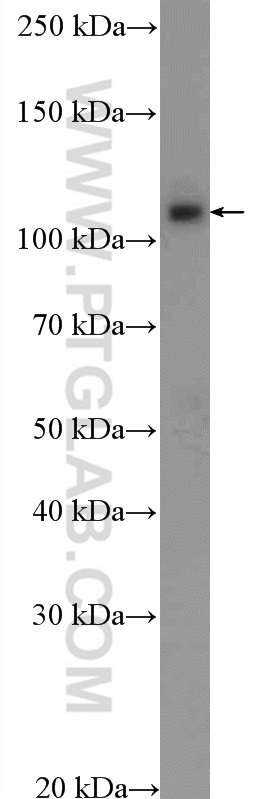 WB analysis of HepG2 using 12719-2-AP