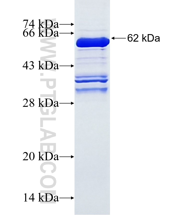 SKIV2L2 fusion protein Ag3414 SDS-PAGE