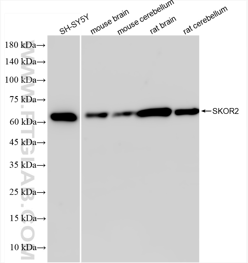 WB analysis using 84303-1-RR (same clone as 84303-1-PBS)