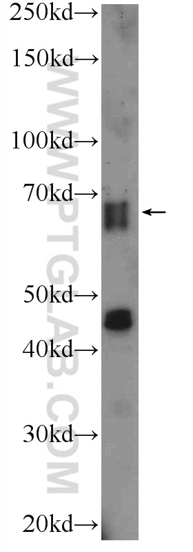 WB analysis of mouse brain using 13908-1-AP