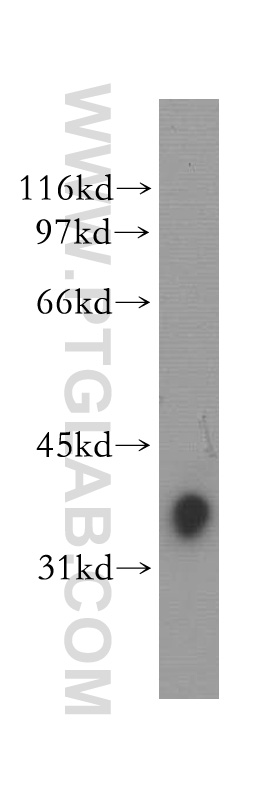 SLAMF7/CD319