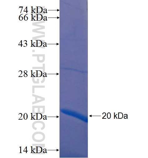 SLC10A5 fusion protein Ag22386 SDS-PAGE