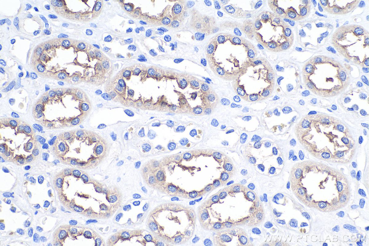 IHC staining of human kidney using 18970-1-AP