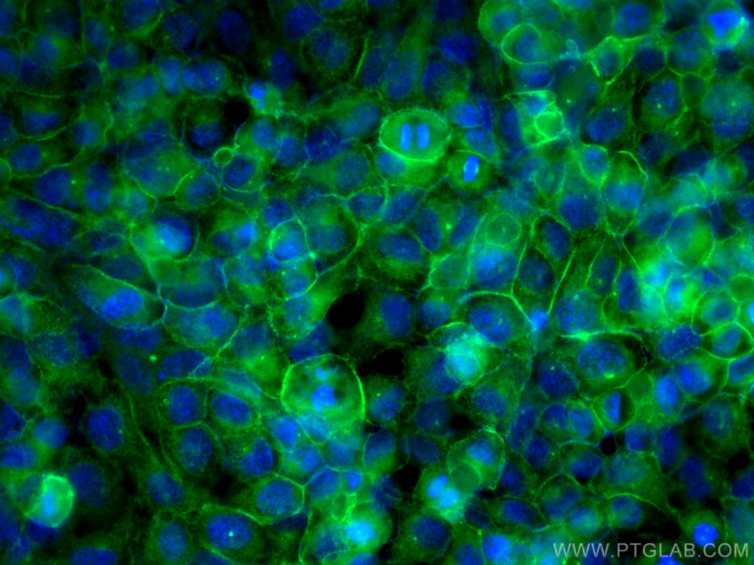 IF Staining of HeLa using 28055-1-AP