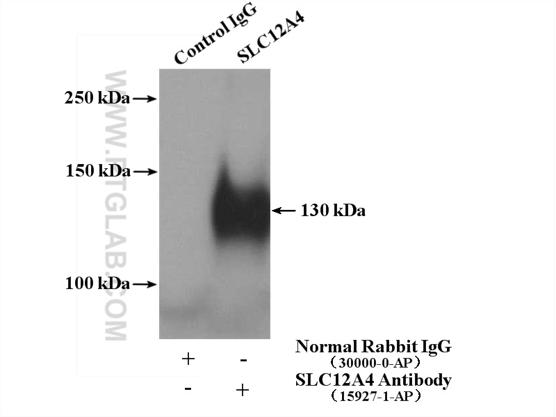 IP experiment of HeLa using 15927-1-AP