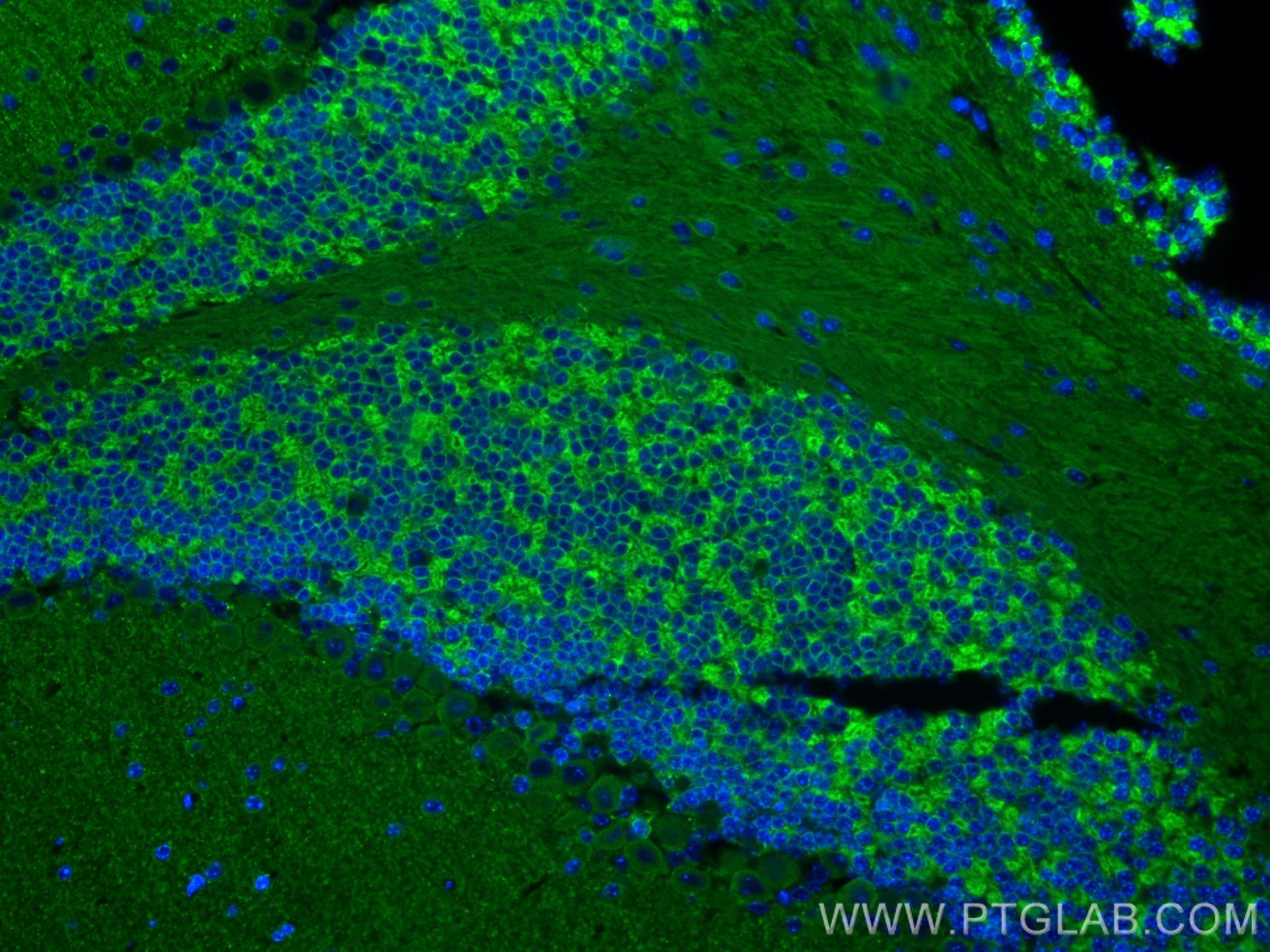 IF Staining of mouse cerebellum using 19565-1-AP