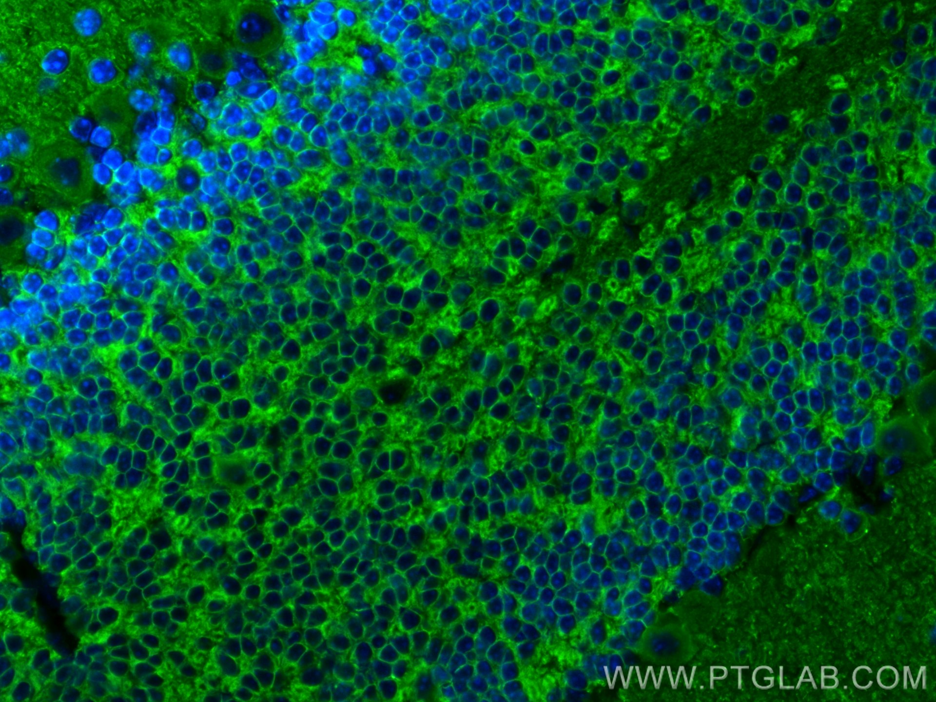 IF Staining of mouse cerebellum using 19565-1-AP