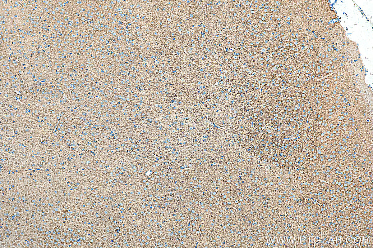 IHC staining of mouse brain using 19565-1-AP