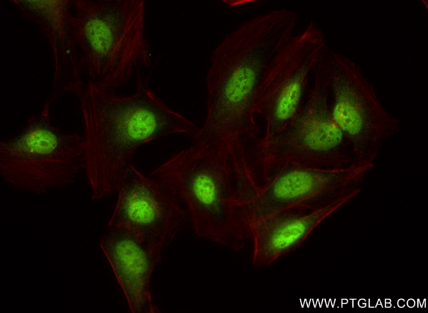 IF Staining of U2OS using 83225-2-RR