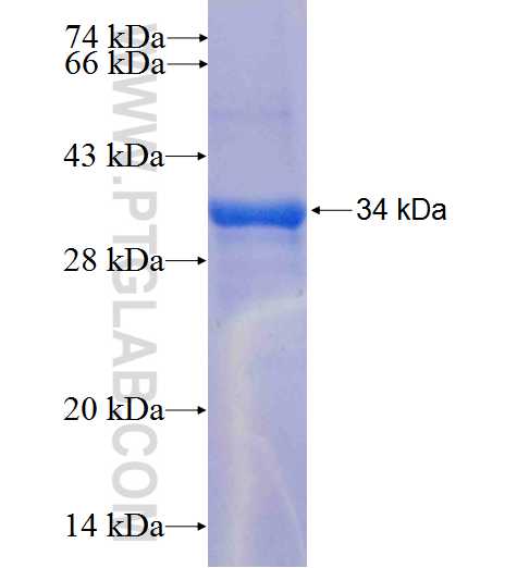 SLC16A11 fusion protein Ag24920 SDS-PAGE