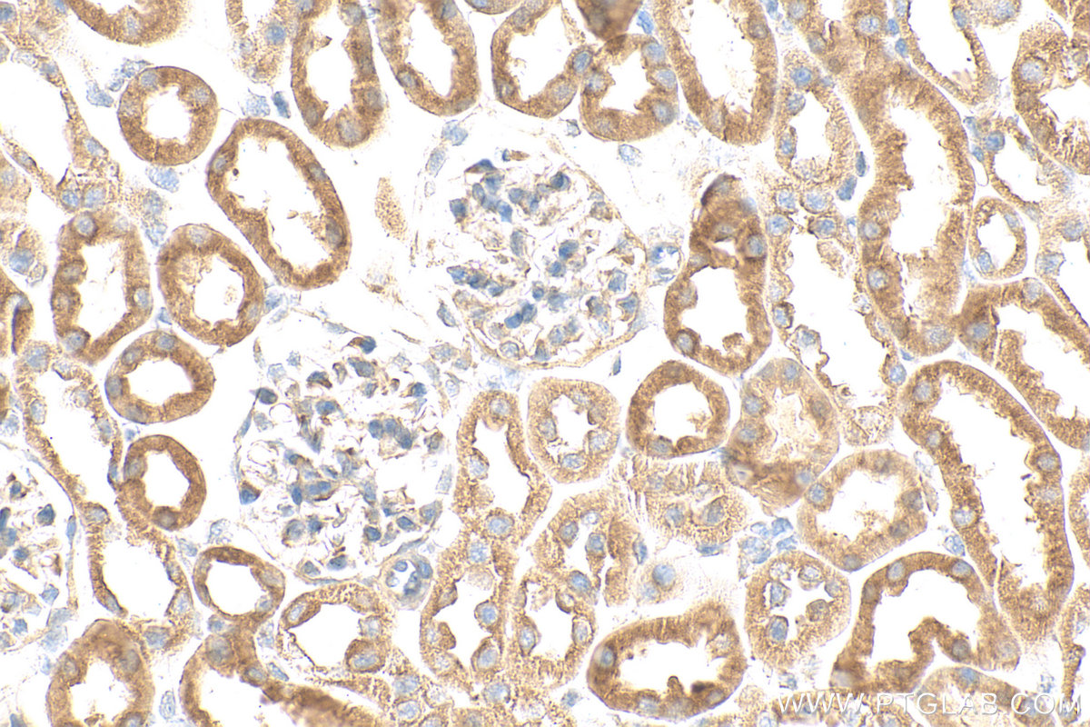 IHC staining of mouse kidney using 20553-1-AP