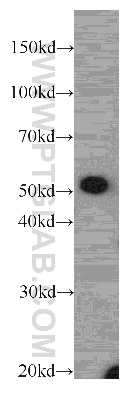 WB analysis of mouse kidney using 20553-1-AP