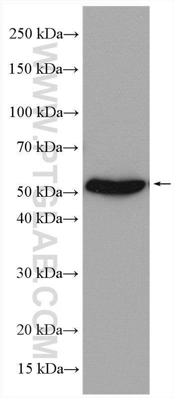 WB analysis of mouse skeletal muscle using 12120-1-AP