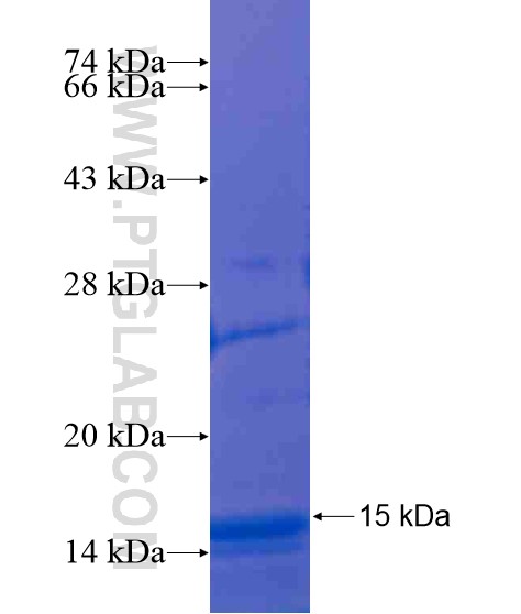 SLC16A6 fusion protein Ag21356 SDS-PAGE