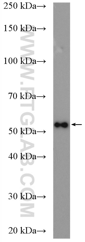 WB analysis of SH-SY5Y using 20355-1-AP