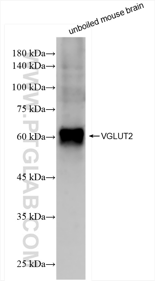 WB analysis of mouse brain using 84083-2-RR (same clone as 84083-2-PBS)