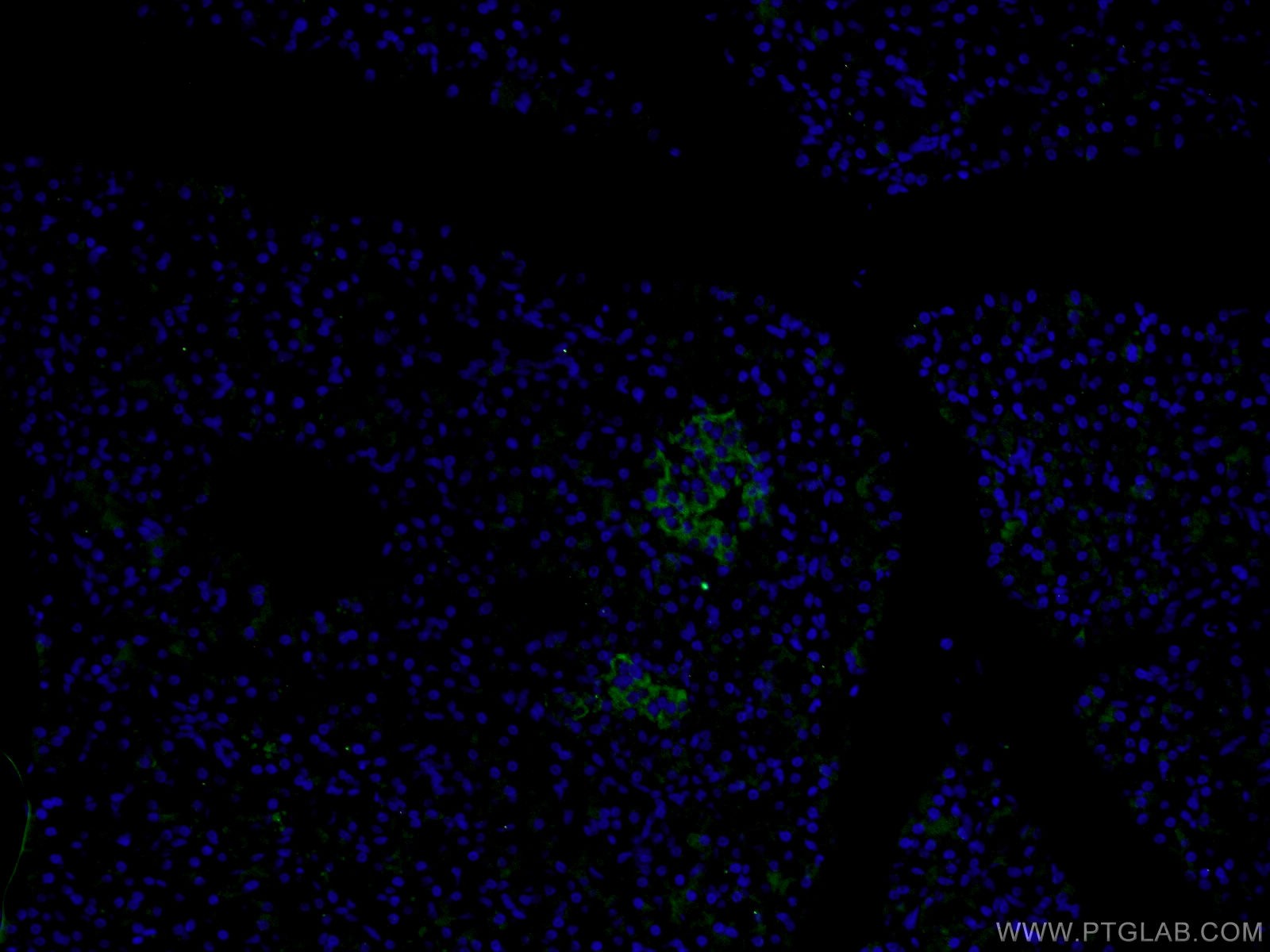 IF Staining of human pancreas using 26731-1-AP