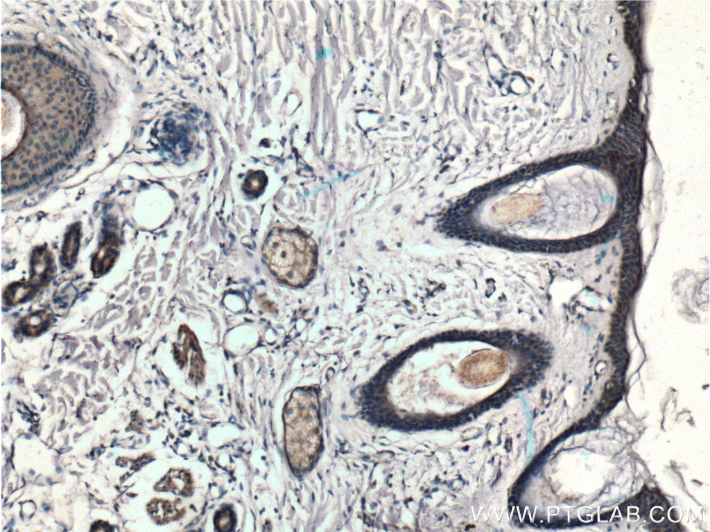 IHC staining of human skin using 26731-1-AP